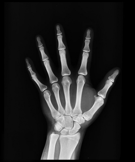 Radiografia