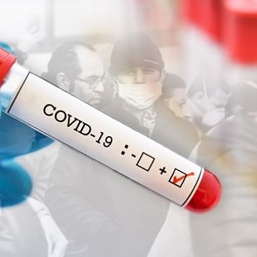 Covid-19 