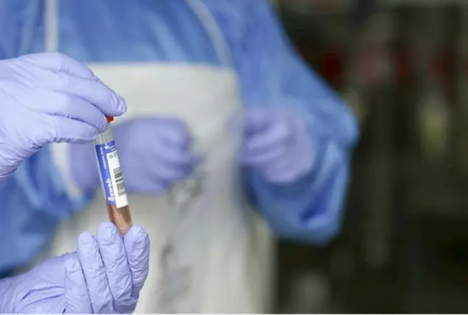 Un sanitario protegido con guantes sostiene un muestra para realizar un Análisis PCR (EUROPA PRESS - ARCHIVO) Un sanitario protegido con guantes sostiene un muestra para realizar un Análisis PCR (EUROPA PRESS - ARCHIVO)