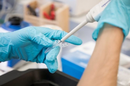 Análisis de una prueba PCR (UNIVERSIDAD DE LA LAGUNA)