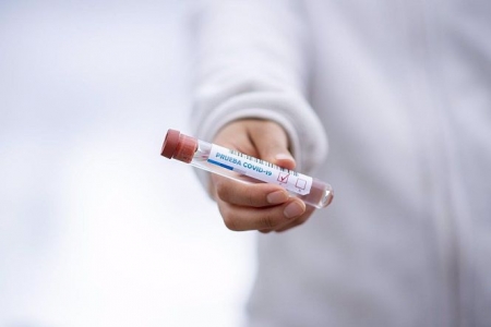 Prueba PCR (EUROPA PRESS)