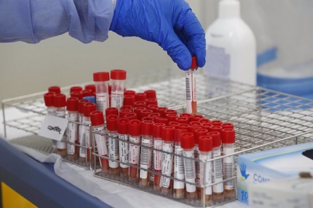 Tubos de pruebas PCR para la detección del COVID-19 (JORGE PETEIRO - EUROPA PRESS)