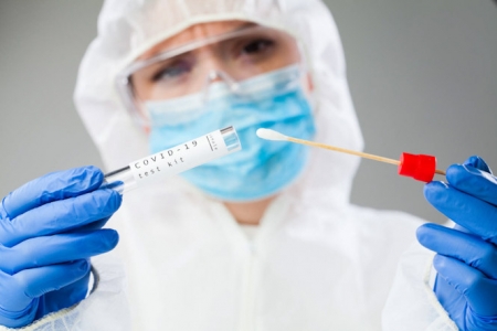  Imagen de un Test PCR (GACETA DENTAL)