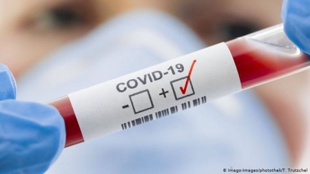 Prueba del Covid-19 (PHOTOTHEK / T. TRUTSCHEL)