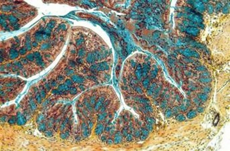 Imagen de un corte del intestino de un ratón afectado con enfermedad inflamatoria intestinal (CSIC) 