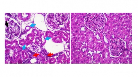 Imágenes microscópicas que muestran el aspecto anormal del riñón (UGR)