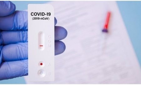 Test de autodiagnóstico del Covid-19 (CONSEJO GENERAL DE COLEGIOS Farmacéuticos)