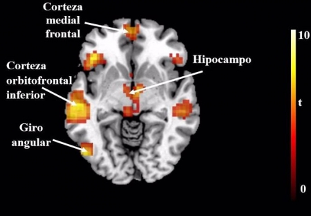Partes del cerebro (UGR)
