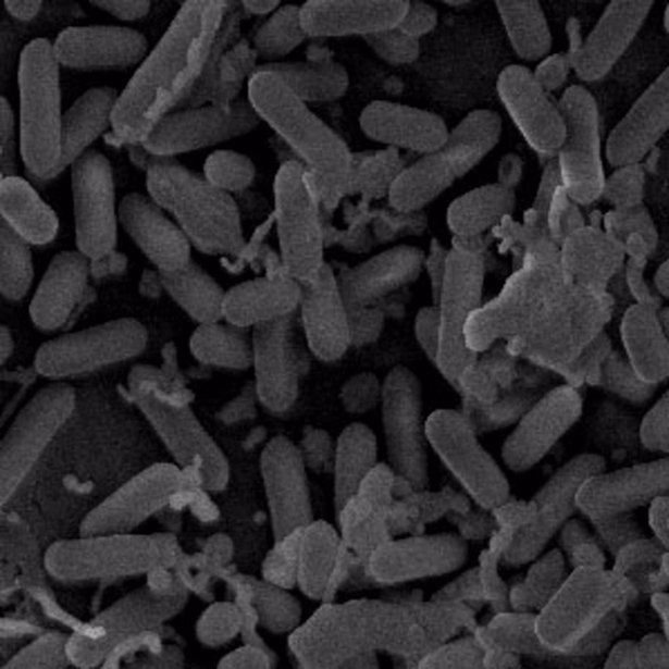 Imagen de archivo de bacterias del género listeria al microscopio (CEU UCH)