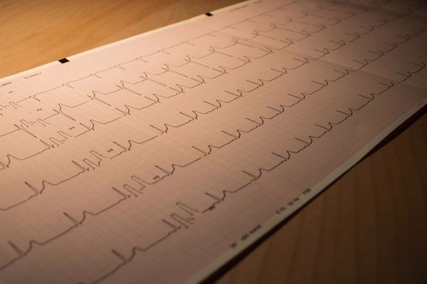 Imagen que ilustra el estudio `Cardiobarómetro español` 8IBS.GRANADA)