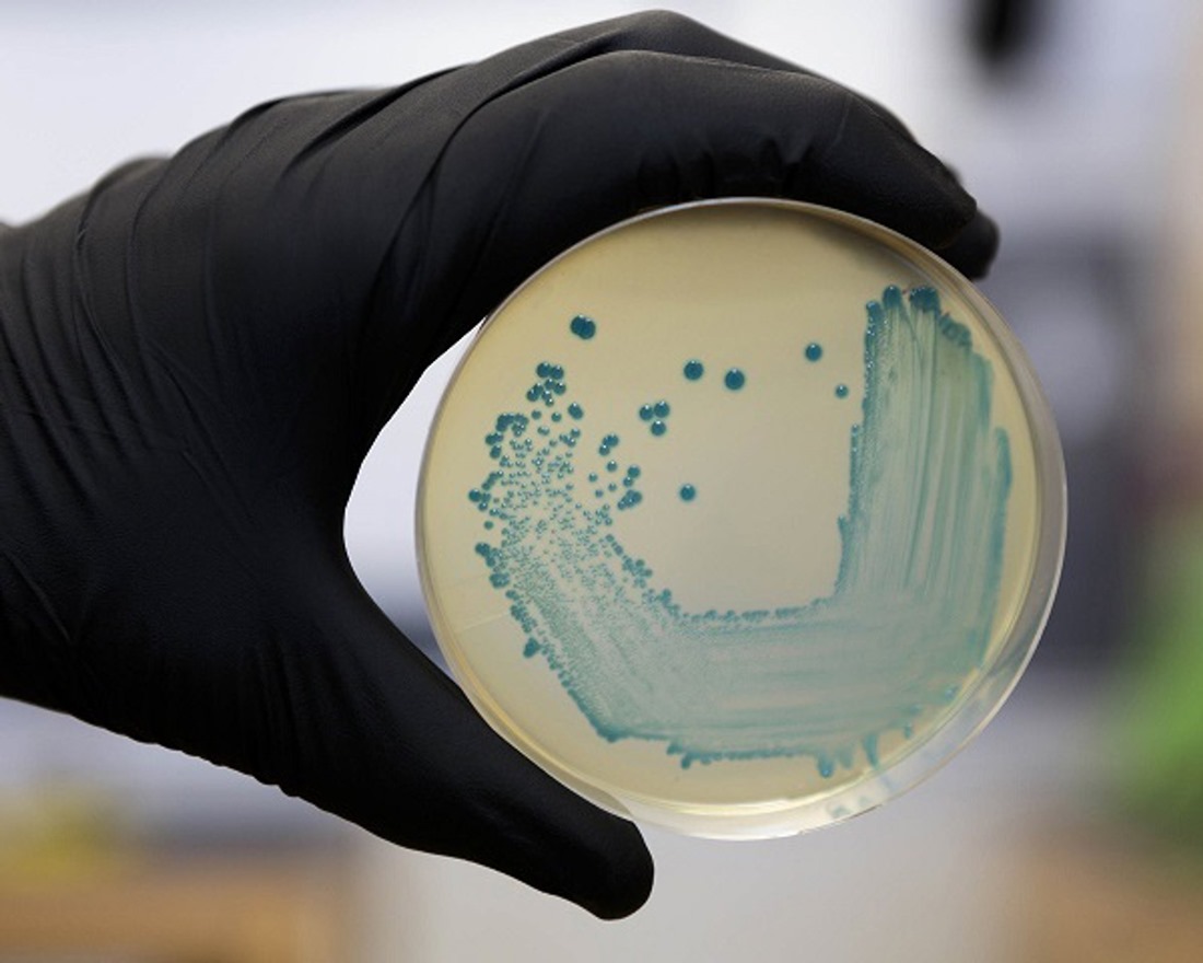 Muestra de listeria monocytogenes, en imagen de archivo (RECTORADO UNIVERSIDAD COMPLUTENSE) Muestra de listeria monocytogenes, en imagen de archivo (RECTORADO UNIVERSIDAD COMPLUTENSE)