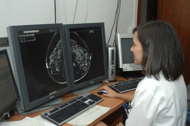 Imagen de archivo de un sistema para la detección precoz del cáncer de mama (JUNTA DE ANDALUCÍA) Imagen de archivo de un sistema para la detección precoz del cáncer de mama (JUNTA DE ANDALUCÍA)