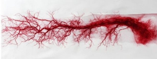 La arteritis de células gigantes afecta principalmente a arterias de gran y mediano calibre, como las que Irrigan la cabeza y el cuello. (CSIC) La arteritis de células gigantes afecta principalmente a arterias de gran y mediano calibre, como las que Irrigan la cabeza y el cuello. (CSIC)