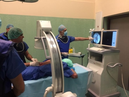 Operación de neuromodulación (JUNTA) 