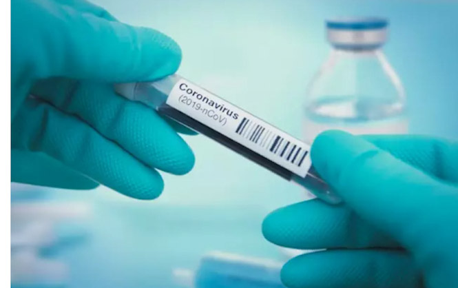 Imagen de recurso del coronavirus. (NARVIKK) 