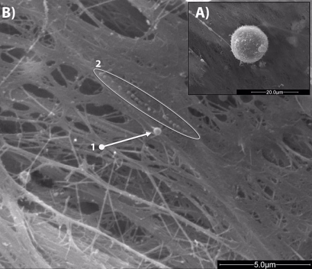 Imágenes SEM de unas célula madres mesenquimales en cultivo. B) 1. Imagen de microvesícula (diámetro 460 nm) y 2. Conjunto de exosomas (diámetro medio 140nm) secretados por las células MSCs (UGR)