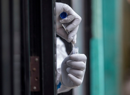 Test PCR (JUNTA DE ANDALUCÍA)