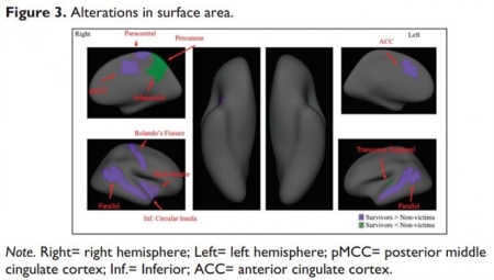 Alteraciones en el área/superficie cerebral (UGR)