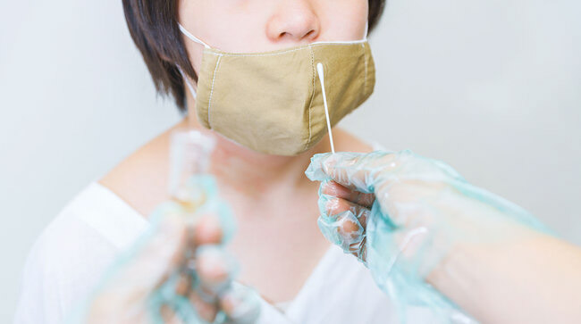 Test PCR (PAHO. ORG) 