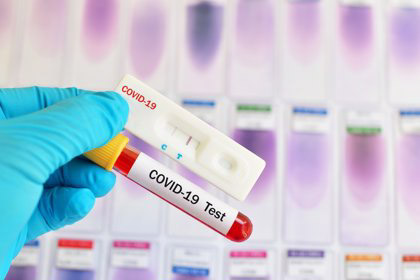 Pruebas del coronavirus, test Covid-19 (JARUN011/GETTY) 