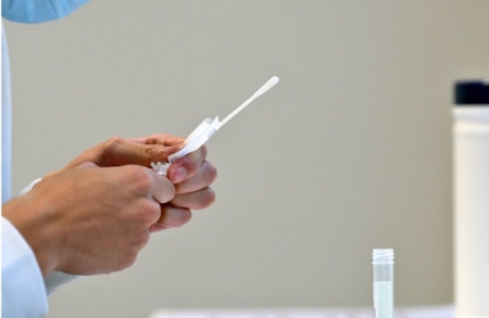 Prueba de RT-PCR para la infección por SARS-CoV-2 (IMPERIAL COLLEGE LONDON) Prueba de RT-PCR para la infección por SARS-CoV-2 (IMPERIAL COLLEGE LONDON)