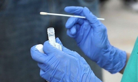 Realización de un test PCR (REDACCIÓN MÉDICA) Realización de un test PCR (REDACCIÓN MÉDICA)