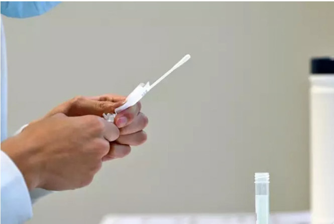 Prueba de RT-PCR para la infección por SARS-CoV-2 (IMPERIAL COLLEGE LONDON) 