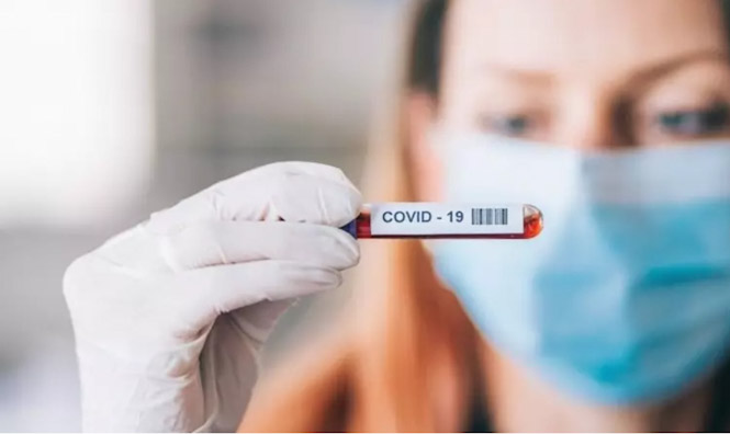 Coronavirus (FARMAINDUSTRIA)