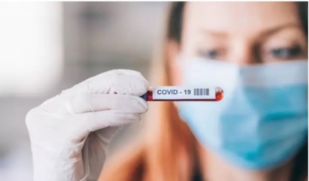 Coronavirus (FARMAINDUSTRIA) Coronavirus (FARMAINDUSTRIA)