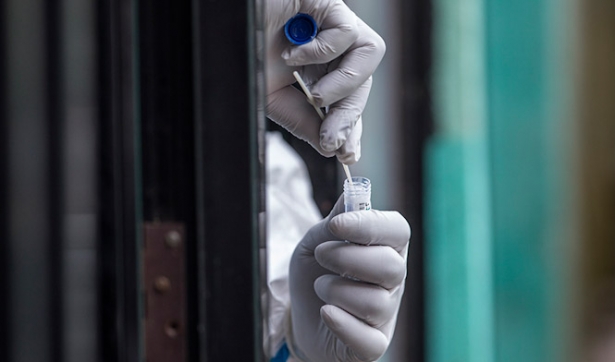 Una prueba PCR para la detección de casos de coronavirus (JUNTA ANDALUCÍA) Una prueba PCR para la detección de casos de coronavirus (JUNTA ANDALUCÍA)