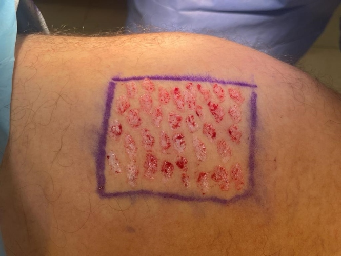 Sello epidermis (JUNTA)