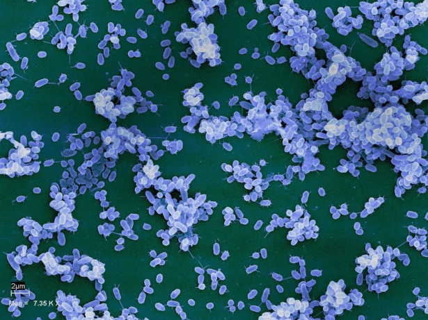 Imagen de bacterias en una superficie de vidrio (EEZ-CSIC)