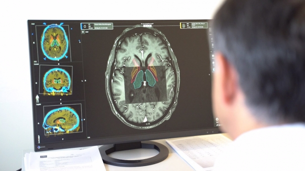 El Hospital Virgen de las Nieves ofrece terapias avanzadas a los pacientes con párkinson (JUNTA DE ANDALUCÍA) El Hospital Virgen de las Nieves ofrece terapias avanzadas a los pacientes con párkinson (JUNTA DE ANDALUCÍA)