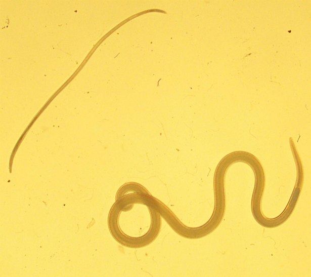 Larvas de anisakis y de Hysterothylacium (UGR)